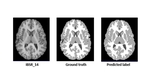 To Design, Analyze, and Implement Approaches for Brain Tissue Segmentation