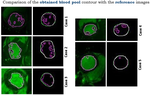 Automatic MRI Cardiac Segmentation in Short Axis for Left Ventricular Endocardium